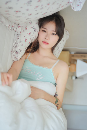 徐真真全身二级深度烧伤